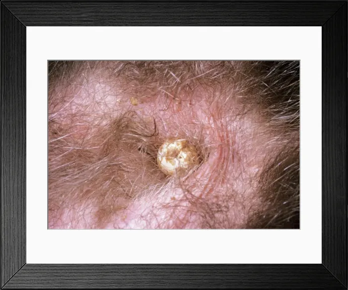 Framed Print : Picture No. 10848371 Framed Print : Picture No. 10848371