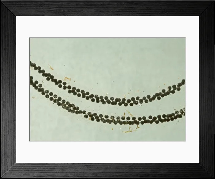 Framed Print : Toadspawn – fresh – common toad – 0. 5 x at 35mm – green background Bedfordshire UK 003624 Framed Print : Toadspawn – fresh – common toad – 0. 5 x at 35mm – green background Bedfordshire UK 003624