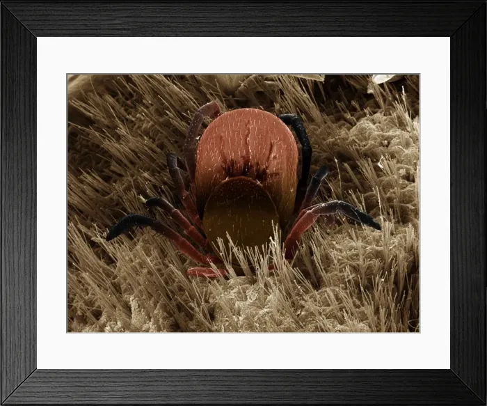 Framed Print : Scanning Electron Micrograph (SEM): Black-legged or Deer Tick, Magnification x 50 (A4 size: 29. 7 cm width) Framed Print : Scanning Electron Micrograph (SEM): Black-legged or Deer Tick, Magnification x 50 (A4 size: 29. 7 cm width)