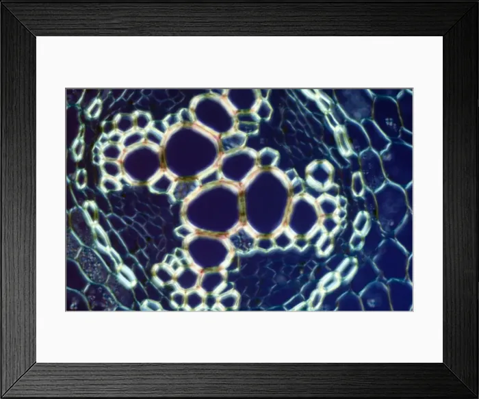 Framed Print : Light Micrograph (LM): transverse section of root of Ranunculus repens (Creeping Buttercup) Framed Print : Light Micrograph (LM): transverse section of root of Ranunculus repens (Creeping Buttercup)