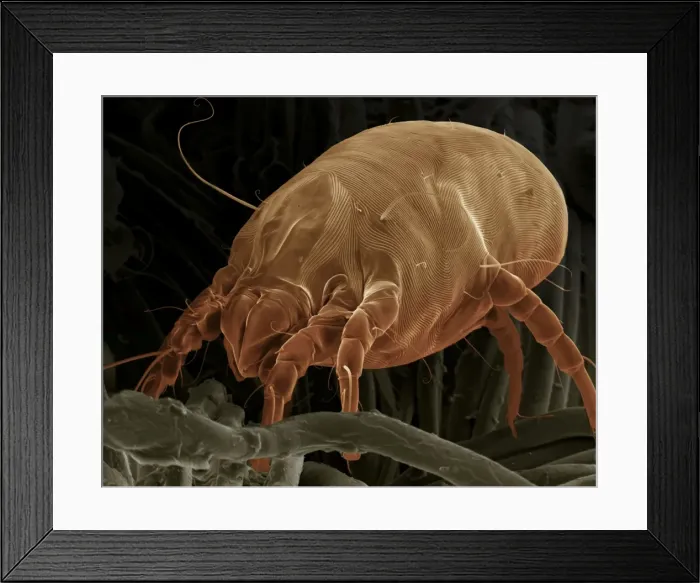Framed Print : Scanning Electron Micrograph (SEM) Dust Mite; Magnification x 700 (A4 size: 29. 7 cm width) Framed Print : Scanning Electron Micrograph (SEM) Dust Mite; Magnification x 700 (A4 size: 29. 7 cm width)