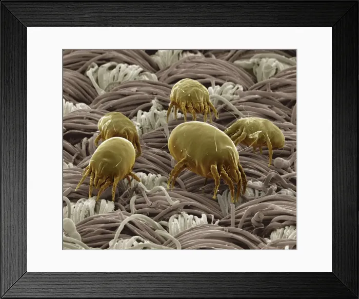 Framed Print : Scanning Electron Micrograph (SEM): Dust Mite ; Magnification x 300 (A4 size: 29. 7 cm width) Framed Print : Scanning Electron Micrograph (SEM): Dust Mite ; Magnification x 300 (A4 size: 29. 7 cm width)
