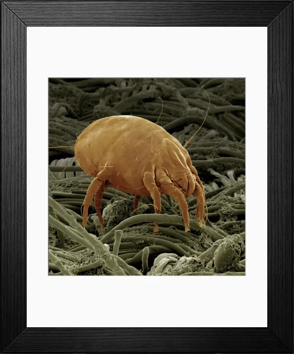 Framed Print : Scanning Electron Micrograph (SEM): Dust Mite; Magnification x 600 (A4 size: 29. 7 cm width) Framed Print : Scanning Electron Micrograph (SEM): Dust Mite; Magnification x 600 (A4 size: 29. 7 cm width)