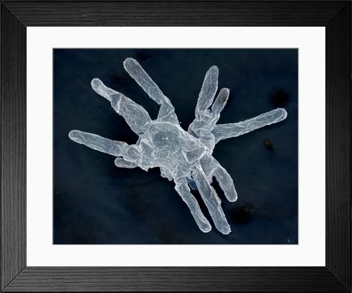 Framed Print : Scanning Electron Micrograph (SEM): Amoeba; Magnification x 850 (A4 size: 29. 7 cm width) Framed Print : Scanning Electron Micrograph (SEM): Amoeba; Magnification x 850 (A4 size: 29. 7 cm width)
