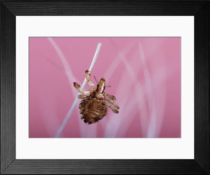 Framed Print : Hog Louse. PPG-1753. Hog Louse. Haematopinus suis Framed Print : Hog Louse. PPG-1753. Hog Louse. Haematopinus suis