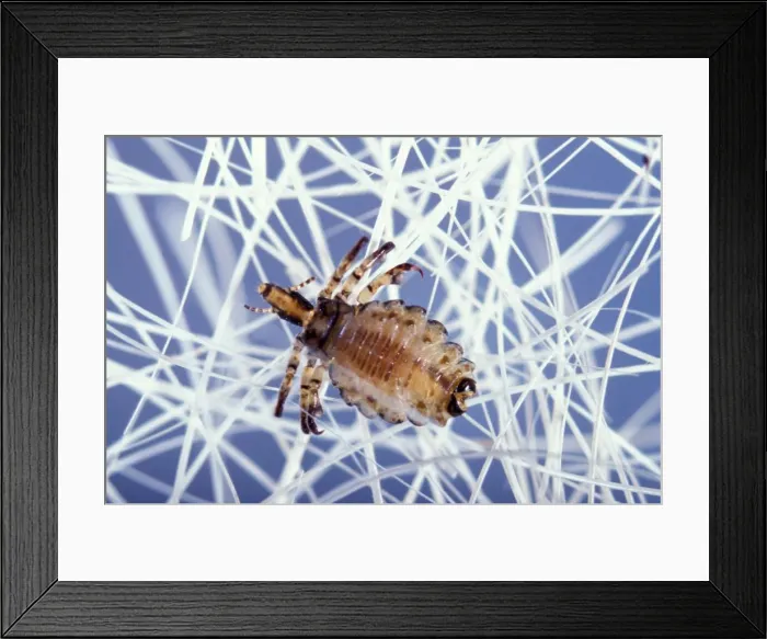 Framed Print : Hog Louse. PPG-1755. Hog Louse. Haematopinus suis Framed Print : Hog Louse. PPG-1755. Hog Louse. Haematopinus suis
