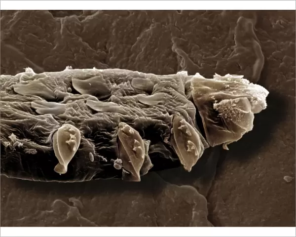 Scanning Electron Micrograph (SEM): Follicle Mite - Magnification x 3800 (if print A4 size: 29. 7 cm wide)