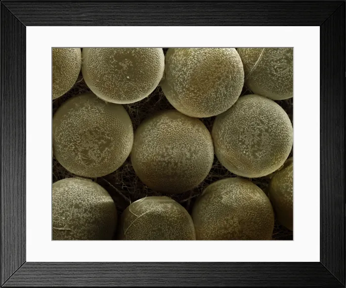 Framed Print : Scanning Electron Micrograph (SEM): Spider Eggs; Magnification x120 (if print A4 size: 29. 7 cm wide)