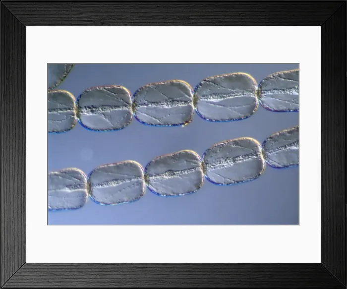 Framed Print : Light Micrograph (LM): Cells from a hair on the stamen of the common spiderwort (Tradescantia) Framed Print : Light Micrograph (LM): Cells from a hair on the stamen of the common spiderwort (Tradescantia)