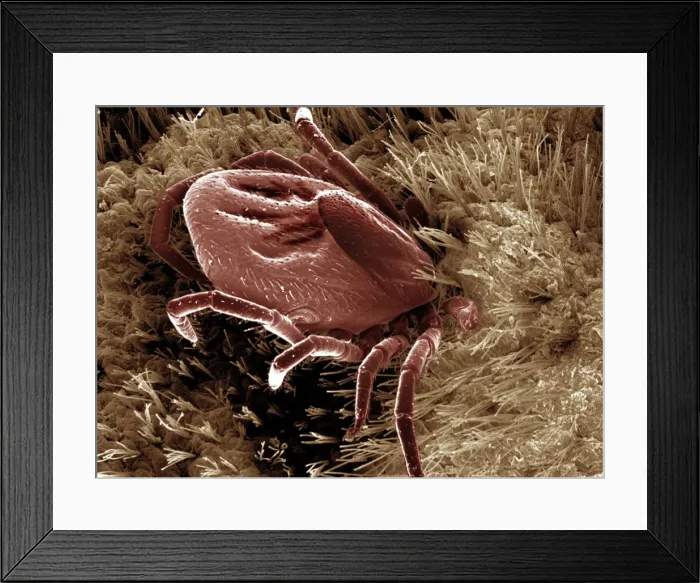 Framed Print : Scanning Electron Micrograph (SEM): Black-legged / Deer Tick - Magnification x 50 (if print A4 size: 29. 7 cm wide) Framed Print : Scanning Electron Micrograph (SEM): Black-legged / Deer Tick - Magnification x 50 (if print A4 size: 29. 7 cm wide)