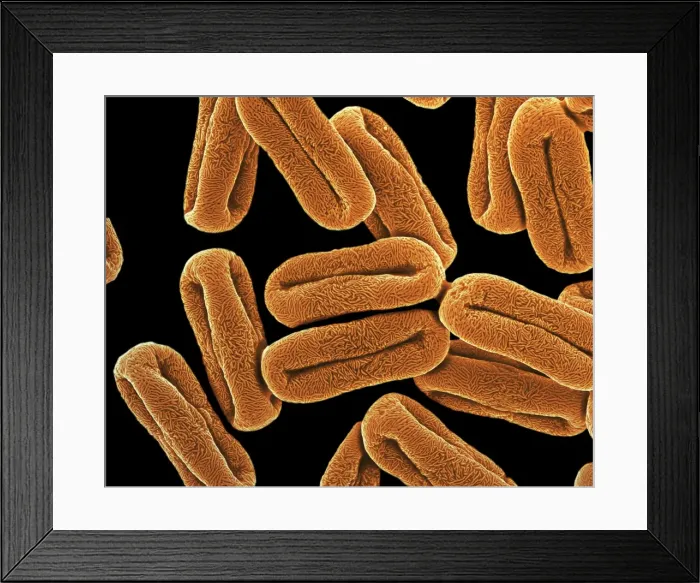 Framed Print : Scanning Electron Micrograph (SEM): Pollen from an Umbelliferous flowering plant; Magnification x 35, 000 (A4 size: 29. 7 cm width) Framed Print : Scanning Electron Micrograph (SEM): Pollen from an Umbelliferous flowering plant; Magnification x 35, 000 (A4 size: 29. 7 cm width)