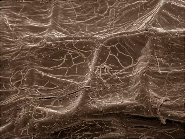 Scanning Electron Micrograph (SEM): Mycorrhiza fungus in plant root; Magnification x 700 (if printed A4, 29. 7 cm wide)