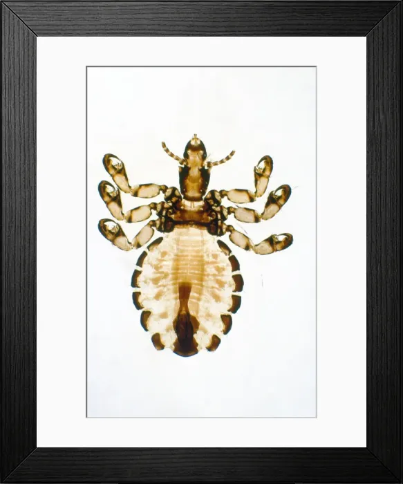 Framed Print : Pig Louse - x5 magnification Framed Print : Pig Louse - x5 magnification
