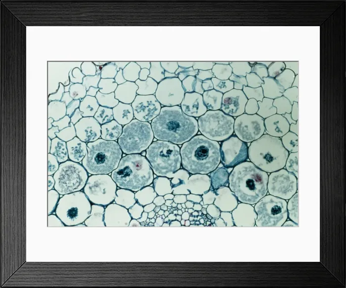 Framed Print : Light Micrograph (LM): Filaments of fungi Endotrophic Mycorrhiza live within cells of a root; Magnification x600 (on 10. 5 cm width print) Framed Print : Light Micrograph (LM): Filaments of fungi Endotrophic Mycorrhiza live within cells of a root; Magnification x600 (on 10. 5 cm width print)