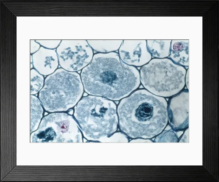Framed Print : Light Micrograph (LM): Filaments of fungi Endotrophic Mycorrhiza live within cells of a root; Magnification x1200 (on 10. 5 cm width print) Framed Print : Light Micrograph (LM): Filaments of fungi Endotrophic Mycorrhiza live within cells of a root; Magnification x1200 (on 10. 5 cm width print)