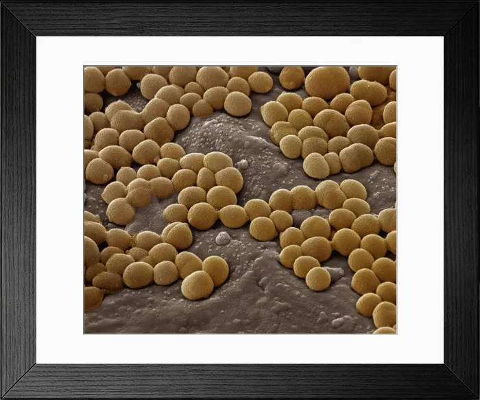 Framed Print : Scanning Electron Micrograph (SEM); Magnification 28, 000 (A4 size: 29. 7 cm width) Framed Print : Scanning Electron Micrograph (SEM); Magnification 28, 000 (A4 size: 29. 7 cm width)