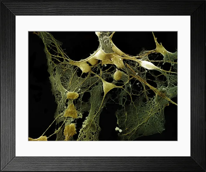 Framed Print : Scanning Electron Micrograph (SEM): Nerve cells grown in a culture Framed Print : Scanning Electron Micrograph (SEM): Nerve cells grown in a culture
