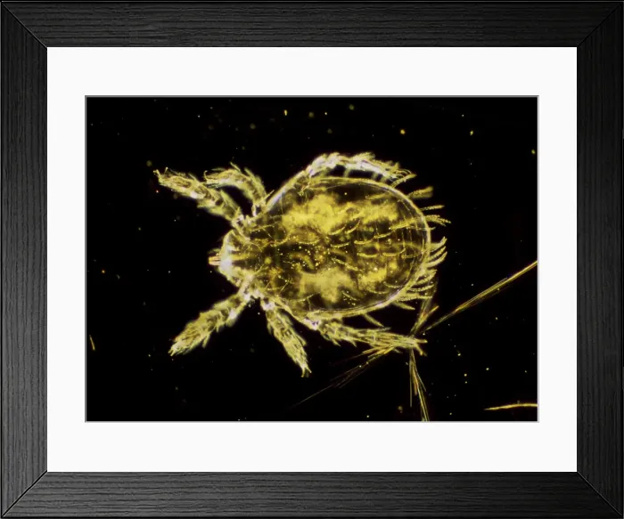 Framed Print : Dark Field Light Micrograph: Scrub Typhus Mite Chigger - Magnification x 125 (if print A4 size: 29. 7 cm wide) Framed Print : Dark Field Light Micrograph: Scrub Typhus Mite Chigger - Magnification x 125 (if print A4 size: 29. 7 cm wide)
