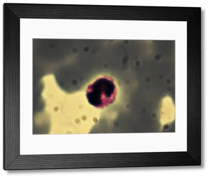 Framed Print : Light Micrograph: Plasmodium: a parasitic protozoa in blood; Magnification x 7, 500 (if print A4 size: 29. 7 cm wide) Framed Print : Light Micrograph: Plasmodium: a parasitic protozoa in blood; Magnification x 7, 500 (if print A4 size: 29. 7 cm wide)