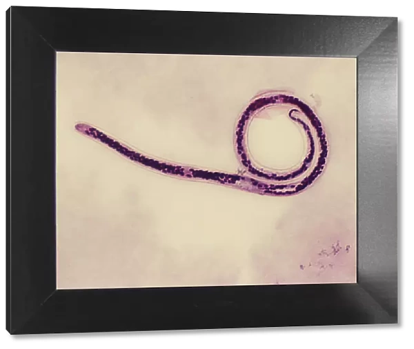 Light Micrograph (SEM): Micro-filarial worm - Magnification x 3000 (if print A4 size: 29. 7 cm wide)