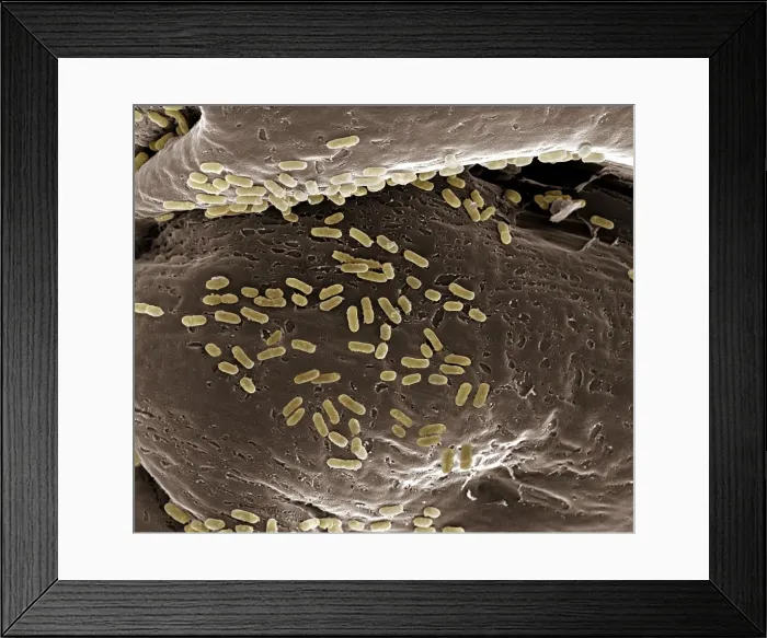Framed Print : Scanning Electron Micrograph (SEM): E. coli; Magnification x 15, 000 (A4 size: 29. 7 cm width) Framed Print : Scanning Electron Micrograph (SEM): E. coli; Magnification x 15, 000 (A4 size: 29. 7 cm width)