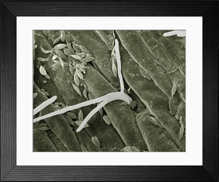 Framed Print : Scanning Electron Micrograph (SEM): Fusarium - Magnification x 2, 500 (A4 size: 29. 7 cm width) Framed Print : Scanning Electron Micrograph (SEM): Fusarium - Magnification x 2, 500 (A4 size: 29. 7 cm width)