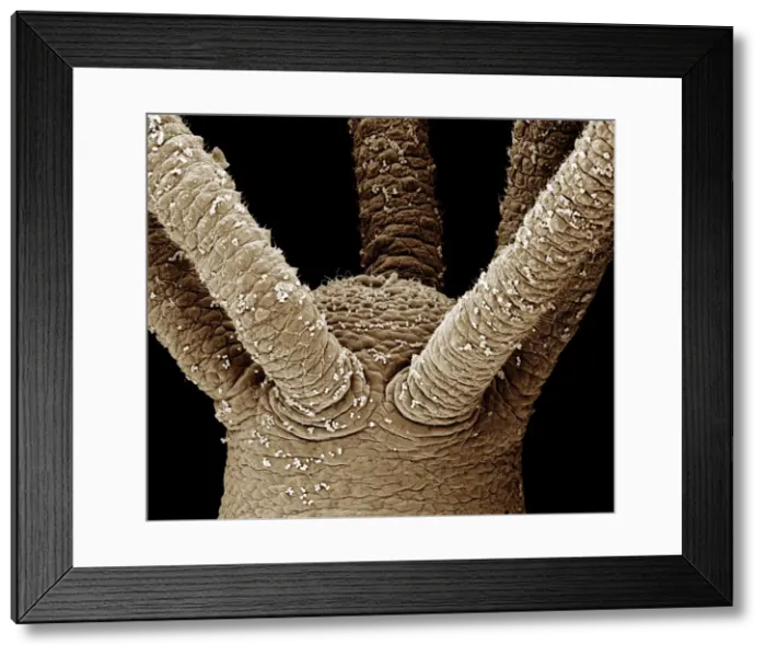 Framed Print : Scanning Electron Micrograph (SEM): close up of tentacles (cnidae) of a Hydra - Magnification unknown Framed Print : Scanning Electron Micrograph (SEM): close up of tentacles (cnidae) of a Hydra - Magnification unknown
