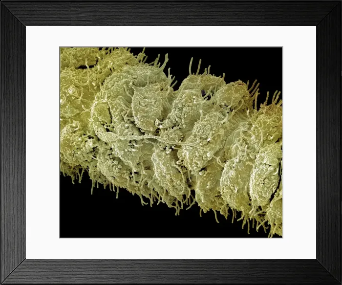 Framed Print : Scanning Electron Micrograph (SEM): close up of a tentacles (cnida) of a Hydra - Magnification unknown Framed Print : Scanning Electron Micrograph (SEM): close up of a tentacles (cnida) of a Hydra - Magnification unknown