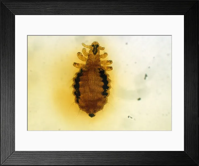 Framed Print : Dog Louse (x10) Framed Print : Dog Louse (x10)