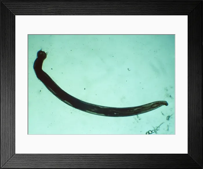 Framed Print : American Hookworm - x 5