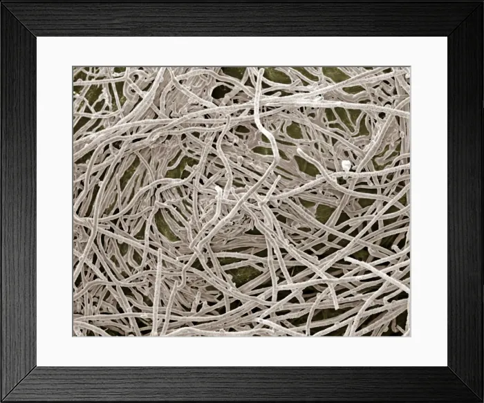 Framed Print : Scanning Electron Micrograph (SEM): Mycorrhiza; Magnification x 1, 500 (A4 size: 29. 7 cm width) Framed Print : Scanning Electron Micrograph (SEM): Mycorrhiza; Magnification x 1, 500 (A4 size: 29. 7 cm width)