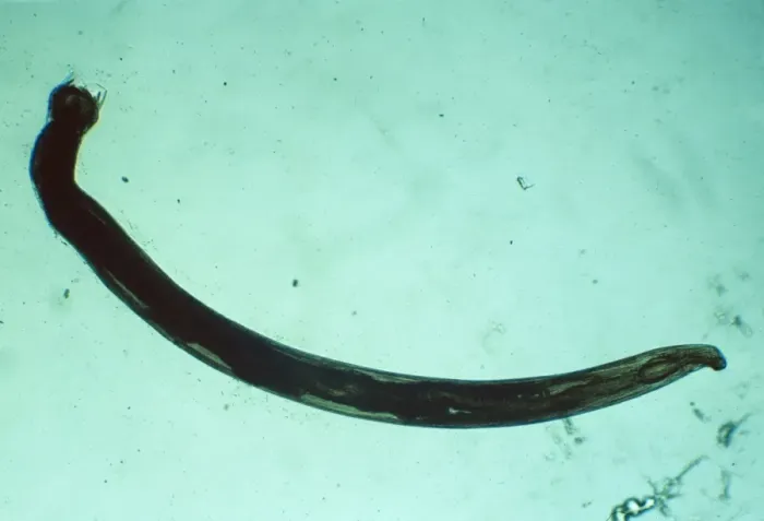 Framed Print : American Hookworm - x 5