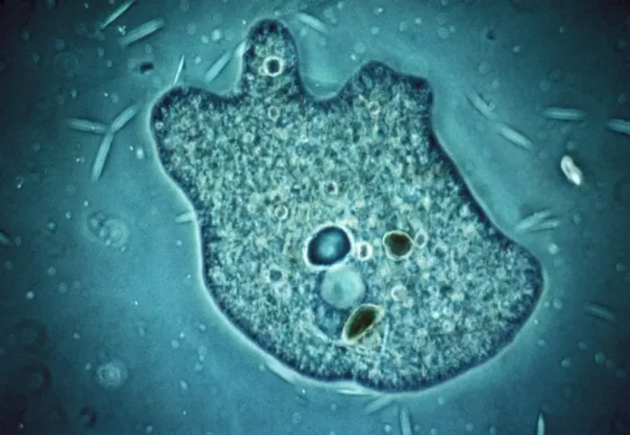 Framed Print : Amoeba - Phase contrast Framed Print : Amoeba - Phase contrast