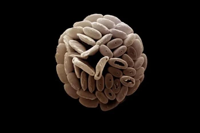 Framed Print : Coccolithophore Framed Print : Coccolithophore