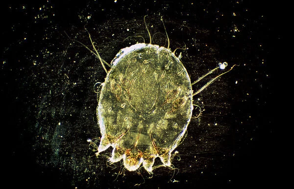 Dark Field Light Micrograph: Scabies Mite