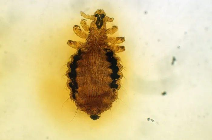 Framed Print : Dog Louse (x10) Framed Print : Dog Louse (x10)