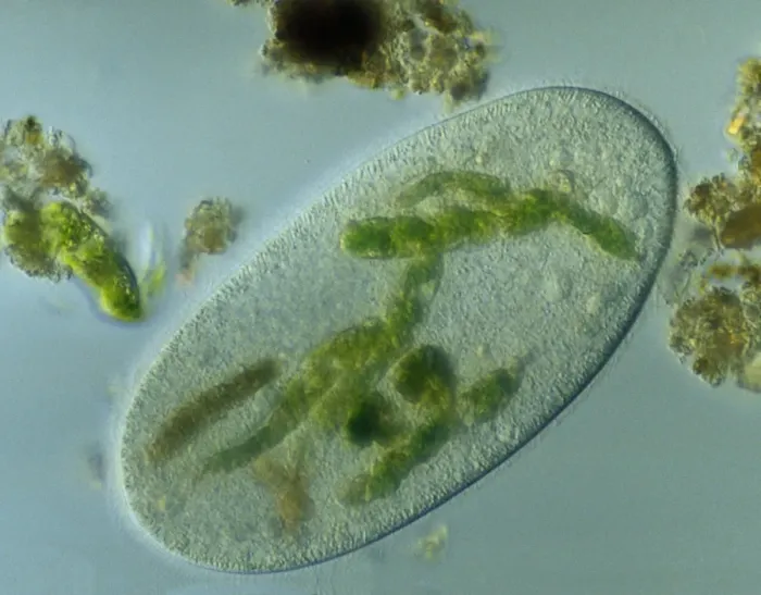 Framed Print : Light Micrograph: Ciliate - Magnification x 750 (when printed A4, 29. 7 cm wide)
