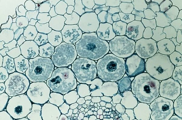 Light Micrograph (LM): Filaments of fungi Endotrophic Mycorrhiza live within cells of a root; Magnification x600 (on 10. 5 cm width print)
