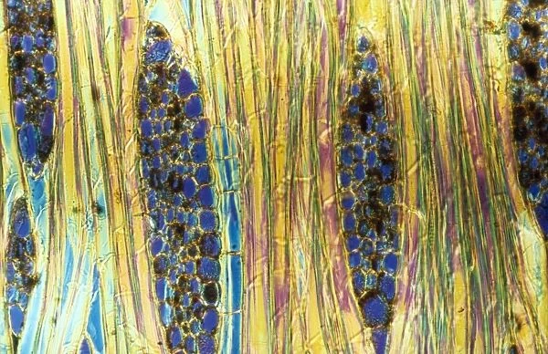 Light Micrograph (LM): Longitudinal section of Mahogany wood, (Pinus sylvestris); Magnification x600 (on 10. 5 cm width print)