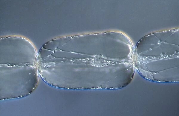 Light Micrograph (LM): A single cell from a hair on the stamen of the common spiderwort (Tradescantia)