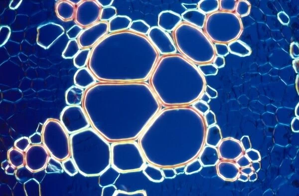 Light Micrograph (LM): A transverse section of a root of Creeping Buttercup, (Ranunculus repens)