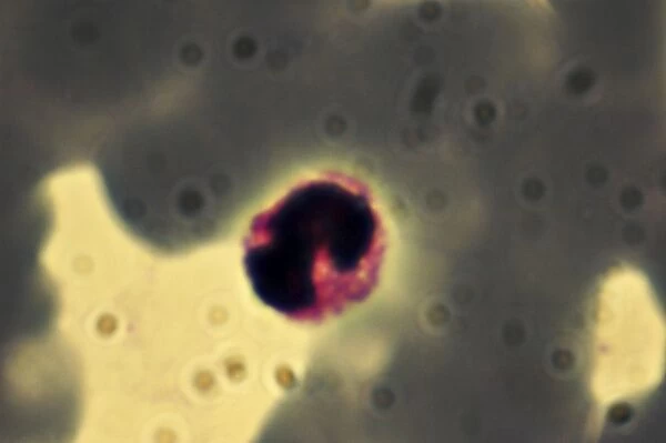 Light Micrograph: Plasmodium: a parasitic protozoa in blood; Magnification x 7, 500 (if print A4 size: 29. 7 cm wide)