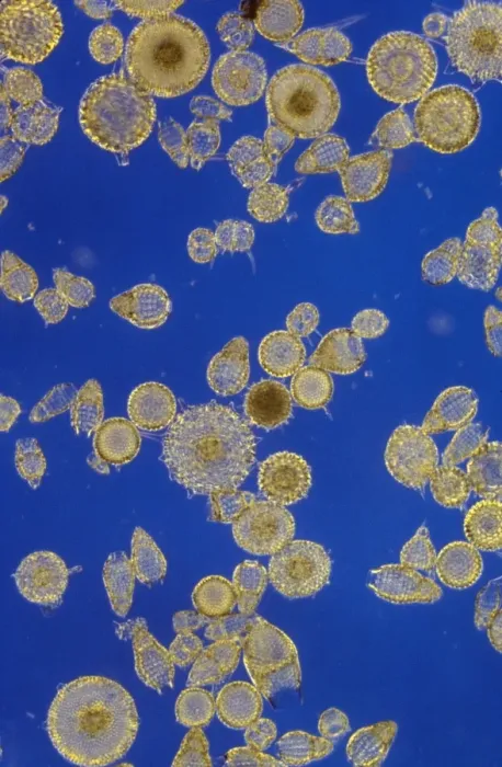 Framed Print : Protozoa - Radiolarians (x20) Actinopoda