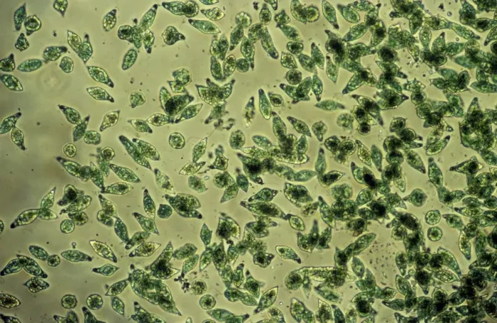 Framed Print : Protozoa - x 50 magnification Framed Print : Protozoa - x 50 magnification