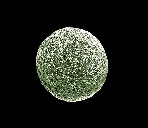 Scanning Electron micrograph (SEM): Grass Pollen grains; Magnification x 3000 (if printed 10. 5 cm wide)