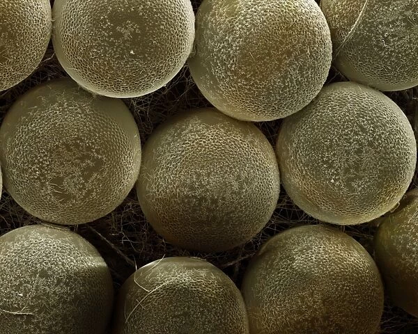 Scanning Electron Micrograph (SEM): Spider Eggs; Magnification x120 (if print A4 size: 29. 7 cm wide)