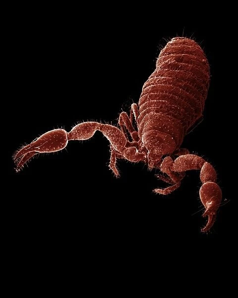Scanning Electron Micrograph (SEM): False Scorpion  /  Pseudoscorpion - Magnification x 75 (if print A4 size: 29. 7 cm wide)