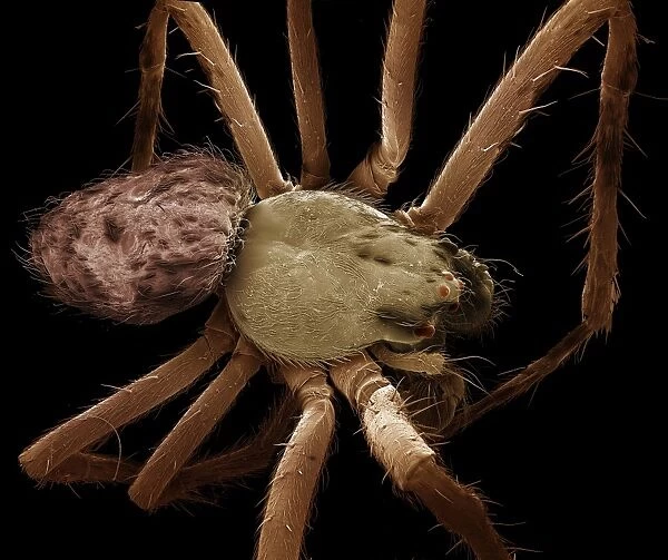 Scanning Electron Micrograph (SEM) : Garden Spider-male, Magnification x20 (A4 size: 29. 7 cm width)
