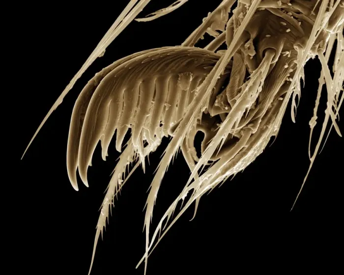 Framed Print : Scanning Electron Micrograph (SEM): a foot of Cellar / Daddy-long-legs Spider - Magnification x 1500 (if print A4 size: 29. 7 cm wide) Framed Print : Scanning Electron Micrograph (SEM): a foot of Cellar / Daddy-long-legs Spider - Magnification x 1500 (if print A4 size: 29. 7 cm wide)