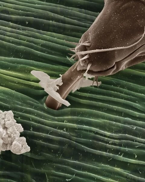 Scanning Electron Micrograph (SEM): Black Aphid - Magnification x 6000 (if print A4 size: 29. 7 cm wide)